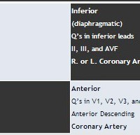 mi location on 12 lead